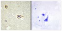CYP19A1 Polyclonal Antibody
