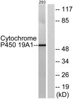CYP19A1 Polyclonal Antibody