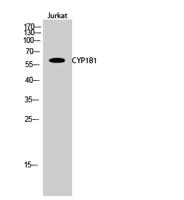 CYP1B1 Polyclonal Antibody