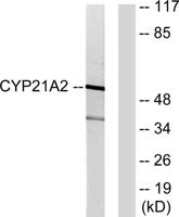 CYP21A2 Polyclonal Antibody
