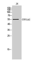 CYP21A2 Polyclonal Antibody