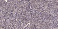 CYP21A2 Polyclonal Antibody