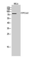 CYP21A2 Polyclonal Antibody