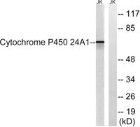 CYP24A1 Polyclonal Antibody
