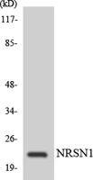 CYP24A1 Polyclonal Antibody