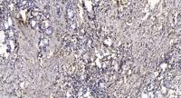 CYP24A1 Polyclonal Antibody