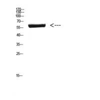 CYP26B1 Polyclonal Antibody