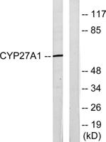 CYP27A1 Polyclonal Antibody