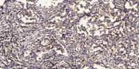 CYP27A1 Polyclonal Antibody
