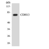 CYP2A13 Polyclonal Antibody