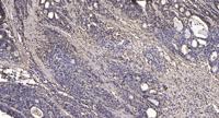 CYP2A13 Polyclonal Antibody