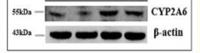 CYP2A6 Polyclonal Antibody