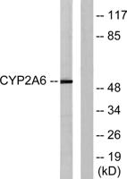 CYP2A6 Polyclonal Antibody