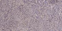 CYP2A6/7 Polyclonal Antibody