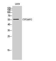 CYP2A6V2 Polyclonal Antibody