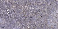 CYP2A6V2 Polyclonal Antibody