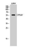 CYP2A7 Polyclonal Antibody