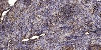 CYP2A7 Polyclonal Antibody