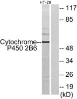 CYP2B6 Polyclonal Antibody