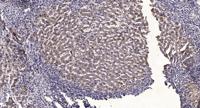 CYP2B6 Polyclonal Antibody