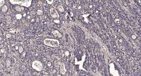 CYP2C19 Polyclonal Antibody