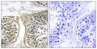 CYP2C8 Polyclonal Antibody