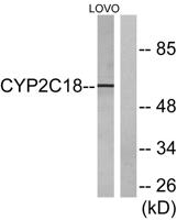 CYP2C8/9/18/19 Polyclonal Antibody