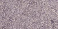 CYP2C8/9/18/19 Polyclonal Antibody