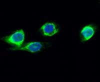 CYP2E1 Polyclonal Antibody