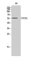 CYP2E1 Polyclonal Antibody
