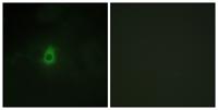 CYP2E1 Polyclonal Antibody