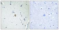 CYP2E1 Polyclonal Antibody