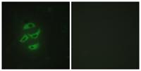 CYP2J2 Polyclonal Antibody
