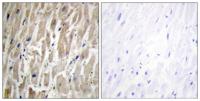 CYP2J2 Polyclonal Antibody