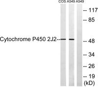 CYP2J2 Polyclonal Antibody