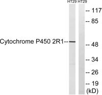 CYP2R1 Polyclonal Antibody