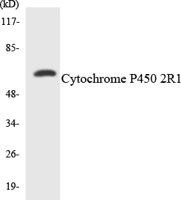 CYP2R1 Polyclonal Antibody
