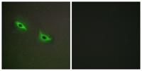 CYP2S1 Polyclonal Antibody