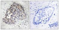 CYP2S1 Polyclonal Antibody