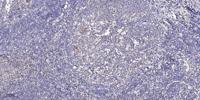 CYP2U1 Polyclonal Antibody