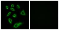 CYP2W1 Polyclonal Antibody