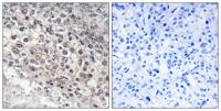 CYP2W1 Polyclonal Antibody