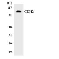 CYP2W1 Polyclonal Antibody