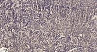 CYP39A1 Polyclonal Antibody