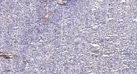 CYP39A1 Polyclonal Antibody