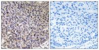 CYP4B1 Polyclonal Antibody