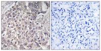 CYP4F2 Polyclonal Antibody