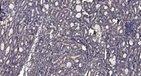CYP4V2 Polyclonal Antibody