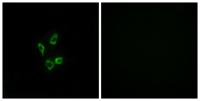 CYP4Z1 Polyclonal Antibody