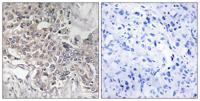 CYP4Z1 Polyclonal Antibody